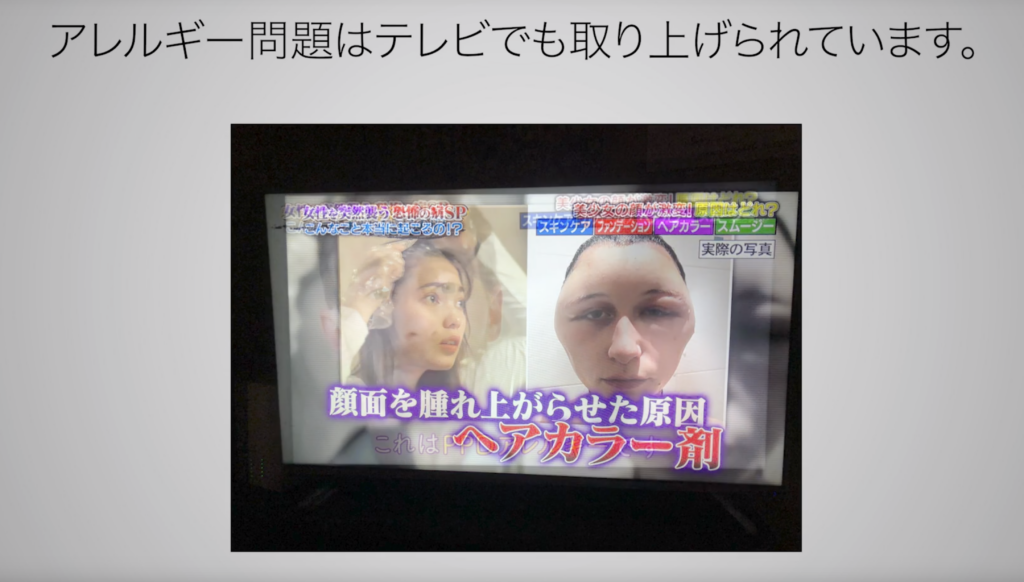 頭皮のフケかゆみアレルギー兵庫県宝塚市の美容室アリシアン（美容院ALLICIANT）お得なキャンペーンメニューや髪質改善 頭皮改善 ジアミンアレルギー対策アクセスマップ、求人情報なども掲載！阪急宝塚線 中山観音駅より徒歩7分、JR福知山線 中山寺駅より徒歩7分 髪整形 イノベーション Badens バーデンス 人気 ヘアサロン
